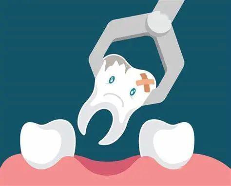 拔牙后发烧是因为拔牙伤身吗 拔牙后应该怎样正确护理呢