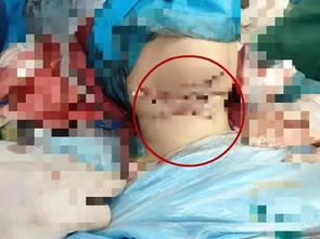 凌晨,22岁女孩遭割喉7刀 她做对的一个动作,救了自己一命