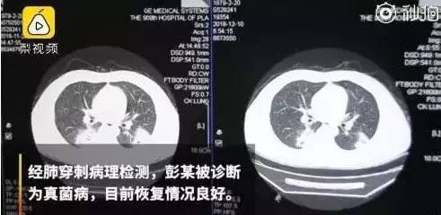 脱袜子先闻闻 一男子因这习惯致致病住院...紫云人,你还敢闻