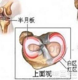 半月板手术后照片 搜狗图片搜索