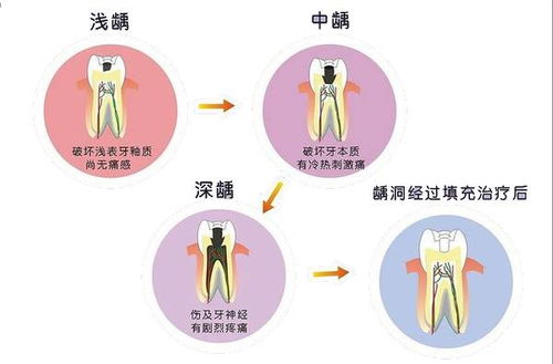 谁说 老掉牙 是一种必然