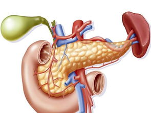 胰腺炎图片 什么是胰腺炎 胰腺炎如何处理 