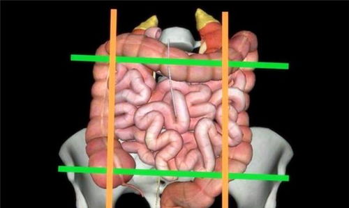 女性左侧腹痛真的是肠道不好吗 你的理解真的正确 看专家的理解