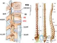 什么是脊柱裂