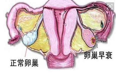 谈谈平时怎样保养卵巢 保养卵巢的好处有哪些