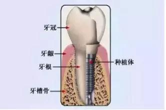 倒计时2天 看人工智能数字化种牙直播