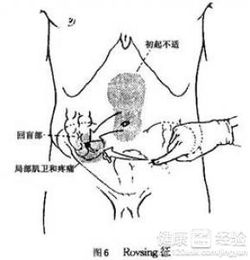 慢性阑尾炎不建议做手术