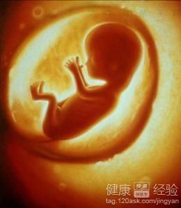 孕妇发烧对胎儿有影响吗，孕妇发烧38.5对胎儿有影响吗