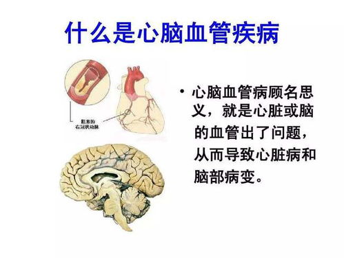 保护心脑血管健康,预防脑出血,做到 一动,二控,三少吃