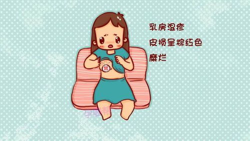 乳房湿疹？乳房周围有湿疹正常吗