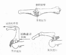 骨科学 第三节 手部骨关节损伤 