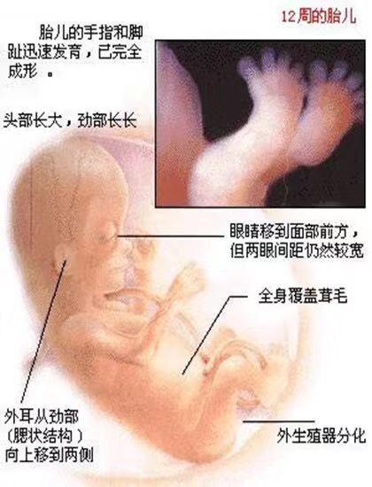 怀孕三个月胎儿有多大(怀孕三个月胎儿大小)