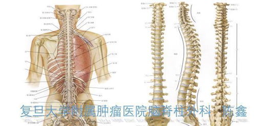 为什么要进行脊柱活检,有哪些意义,活检安全吗,活检怎么做