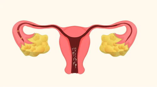 排卵正常为啥怀不上 原因可能是