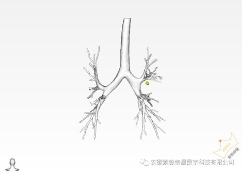 紫薇帝星助力成医附院实现肺段切除领域新突破