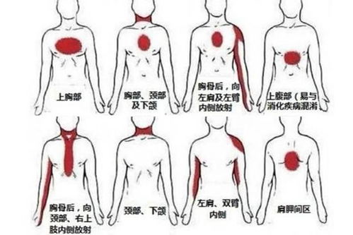 右后背疼痛位置图详解 搜狗图片搜索