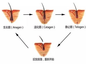 秃如其来 产后脱发怎么办 原因和解决方法都在这里