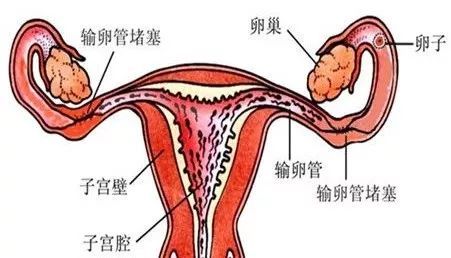 输卵管通畅为什么不怀孕呢