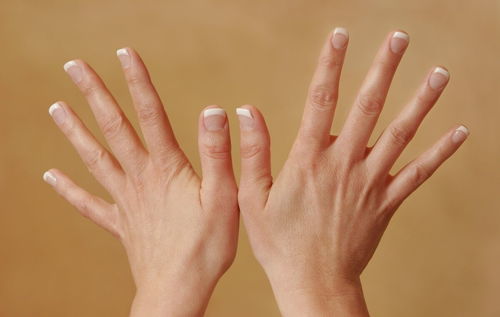 每个指甲上的半月痕有区别吗