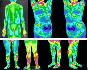 面部红外热成像检查
