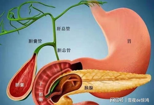 结石是 吃 出来的 提醒 不想结石越长越大,需要注意这4点