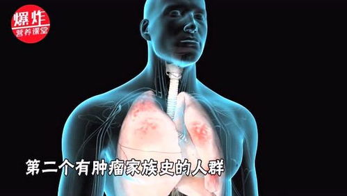 体检时发现肺部有小结节,是严重肺部疾病吗 医生告诉你原因 
