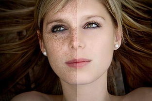 脸上长斑可能是身体哪部分出现了问题 色斑如何形成
