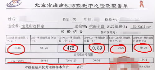 hiv抗体检测 艾滋病该如何检查出来