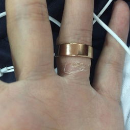 我在淘宝上买了一个diy戒指,可以刻字的那种,觉得非常有意义,就买了 卖家说是钛钢材料的,我戴了几 