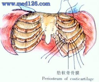 鸡胸矫形术操作步骤,图片图谱图解,手术治疗方法,诊断胸壁手术 