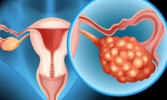 卵巢好的女人,一般得不了这种病,保护卵巢不妨常吃两种食物