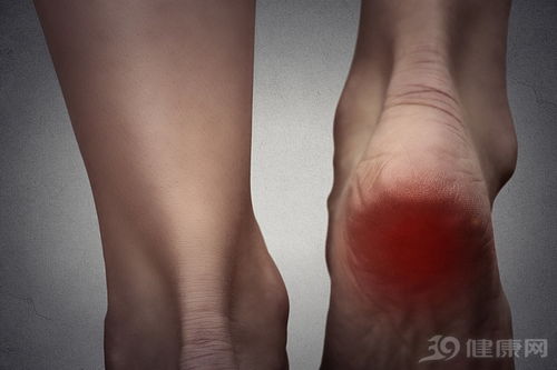 身体好不好,看脚就知道 脚上出现这6种情况,就是疾病的前兆