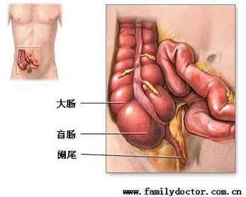 阑尾炎部位疼怎么回事，阑尾已经割掉了(阑尾割掉后还疼)