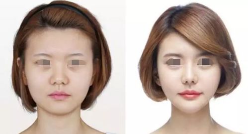 6种不同脸型的改善 原创