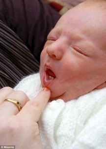美国初生男婴长两颗门牙 医生称十分罕见 