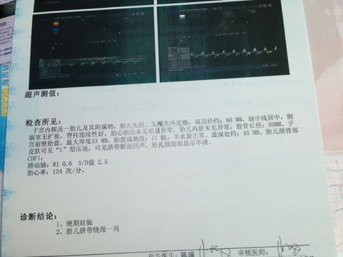 懂得算宝宝体重的辣妈帮我算算宝宝现在有几斤了吧