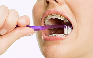牙齿矫正会引起牙龈萎缩吗 牙龈萎缩是怎样形成的