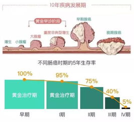 肠癌晚期死亡率95 这4种人,别忽视以下早期症状