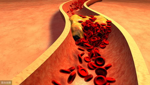 血脂偏高各种并发症,养成2个好习惯,清光血管垃圾,调节血脂