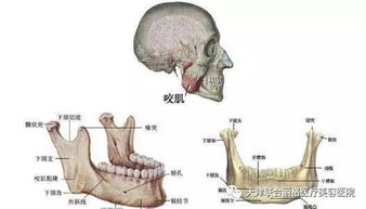 问一个严肃的问题,拔智齿真的能瘦脸吗 