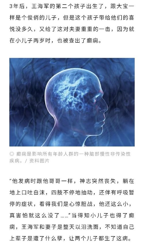 我只是癫痫,不是精神病